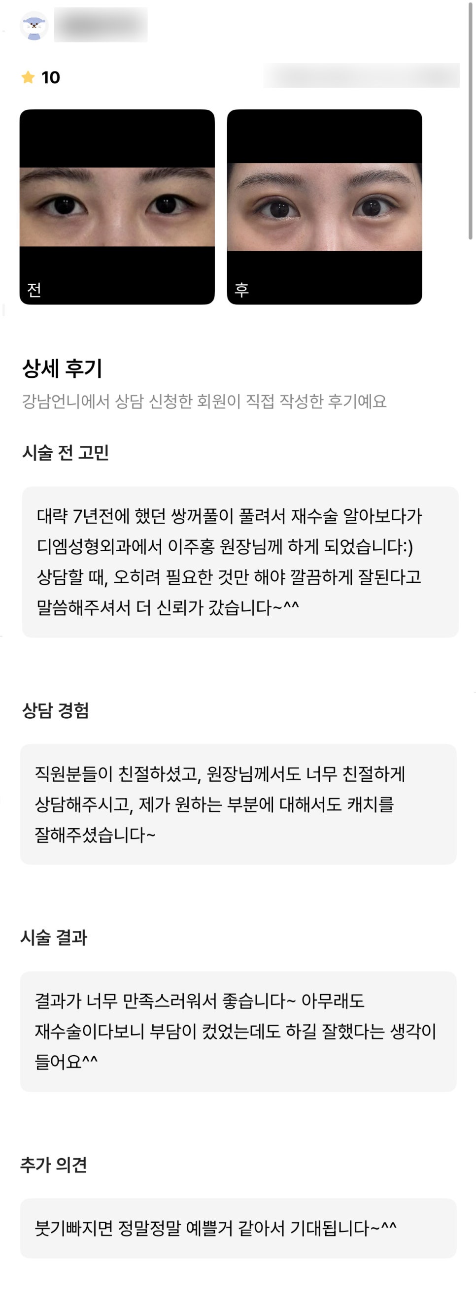 눈재수술 후기."재수술이다보니 부담이 컸었는데도 하길 잘했다는 생각이 들어요!" 관련 이미지 1