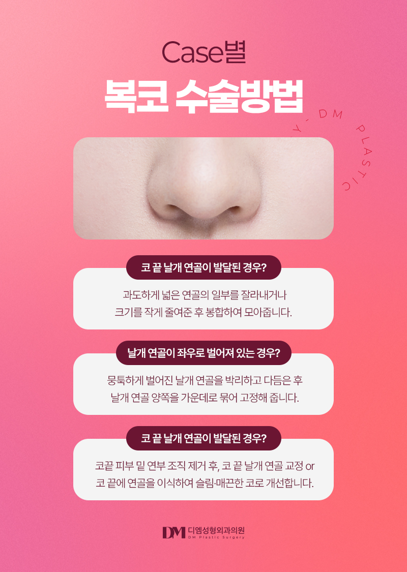 복코성형, 둔해보이는 인상에서 세련된 인상으로! 관련 이미지 5