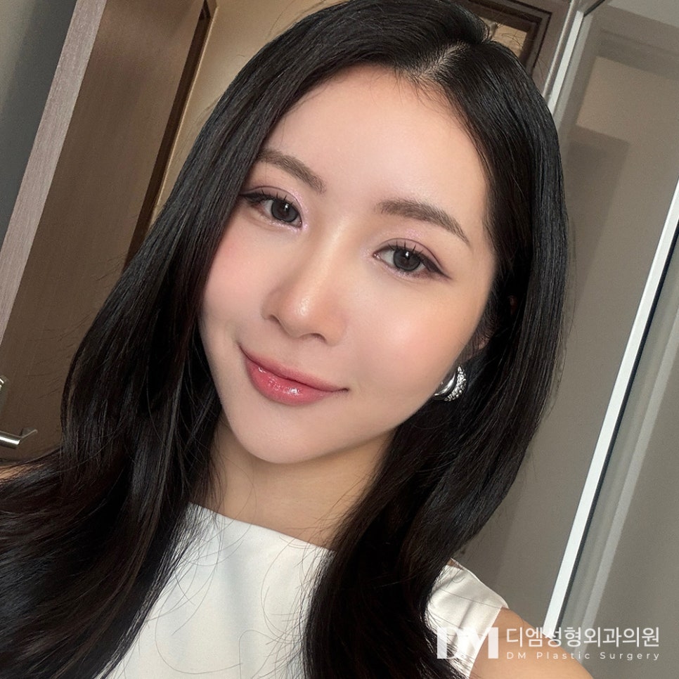 쌍꺼풀수술, 자연스럽고 부드러운 인상 만들기 관련 이미지 1