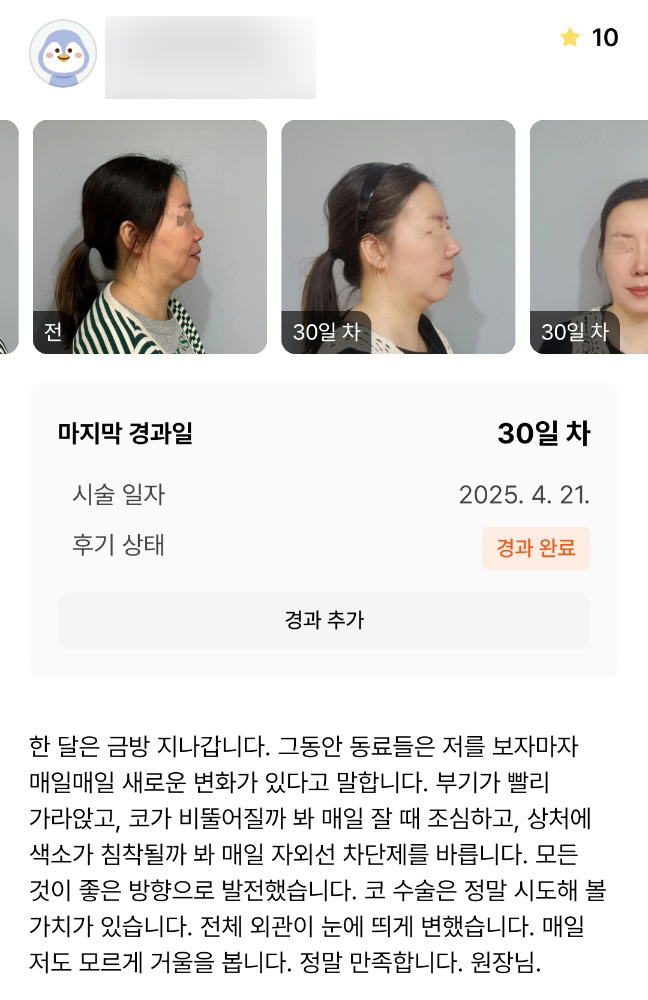코성형 후기."매일 저도 모르게 거울을 봅니다 !" 관련 이미지 1