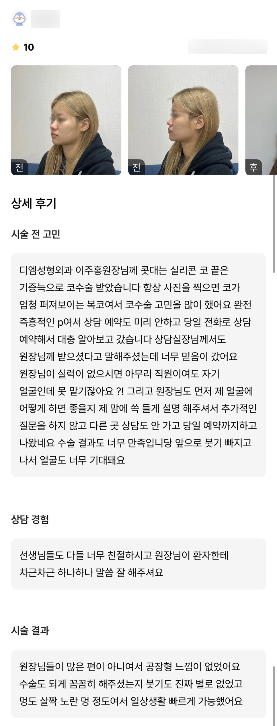 코성형 후기."너무 만족스러워서 붓기 빠진 모습도 기대돼요!" 관련 이미지 1