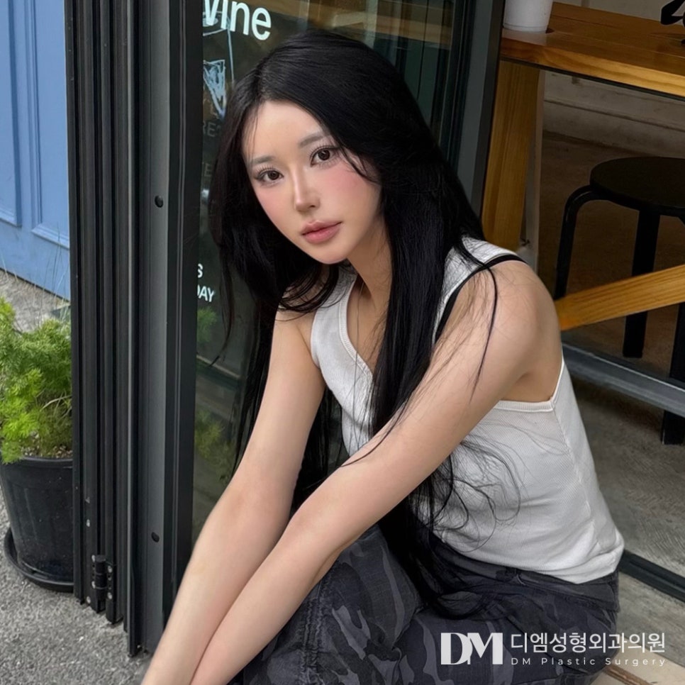쌍꺼풀수술, 내게 맞는 방법으로 인상 개선하기 관련 이미지 1