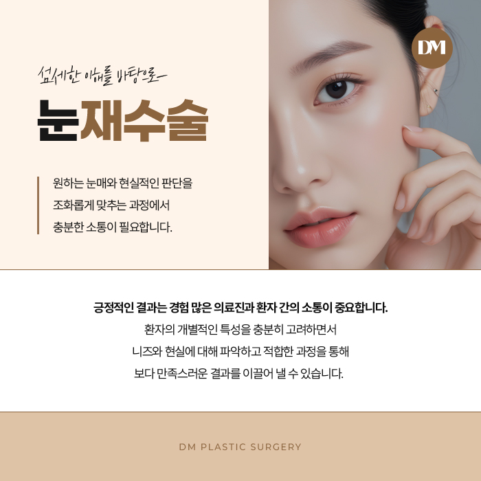 Revision Eyelid Surgery: A Natural Line That Suits My Eyes image 9