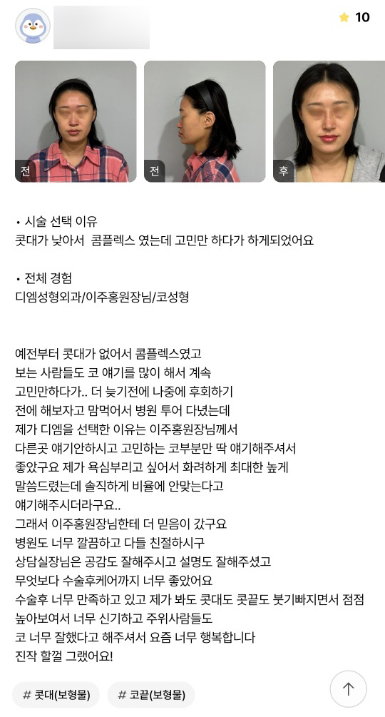 코성형 후기."요즘 너무 행복합니다 진작 할껄 그랬어요!" 관련 이미지 1