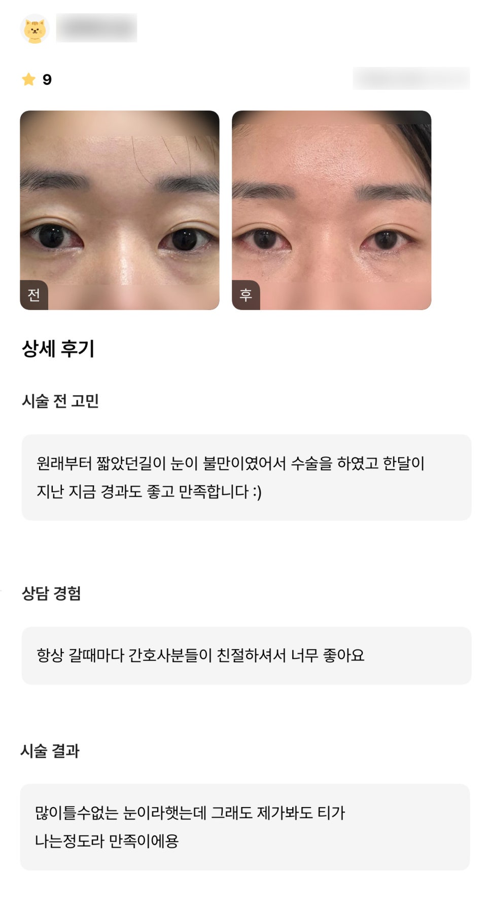 Bbang-twim Review. "One month later, the progress is good and I’m satisfied :)" image 1
