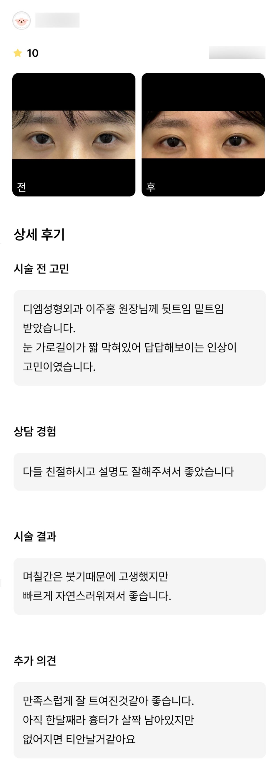뒤밑트임 후기."빠르게 자연스러워져서 좋습니다" 관련 이미지 1