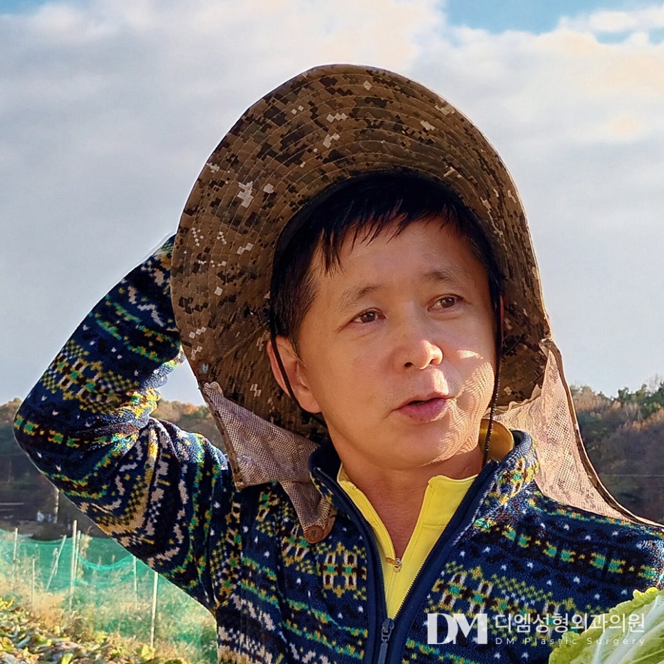 상안검, 눈꺼풀의 노화 해결하기 관련 이미지 1