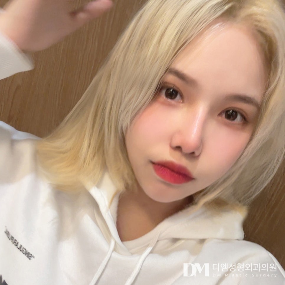 이마거상, 이마 주름과 처진 눈매를 한번에 교정하고 싶다면? 관련 이미지 1