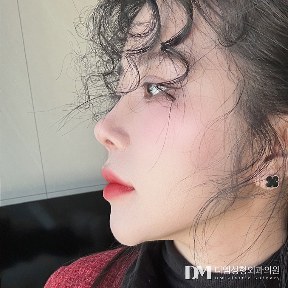 매부리코 , 어느각도에서든 당당한 코 라인으로 관련 이미지 1