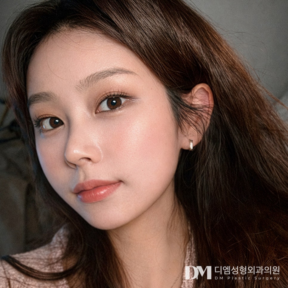 디엠 눈재수술 전후사진, 더 이상 실패하지 않으려면! 관련 이미지 1