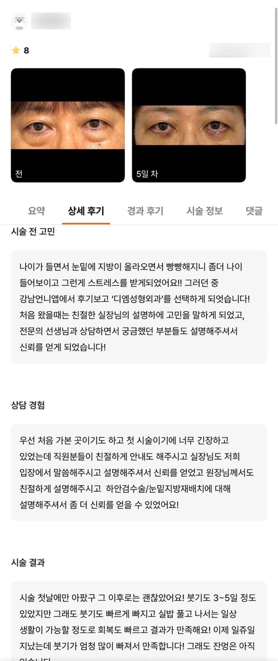 하안검 후기."실밥 풀고 나서는 일상 생활이 가능할 정도로 회복도 빠르고 결과도 만족해요 !" 관련 이미지 1
