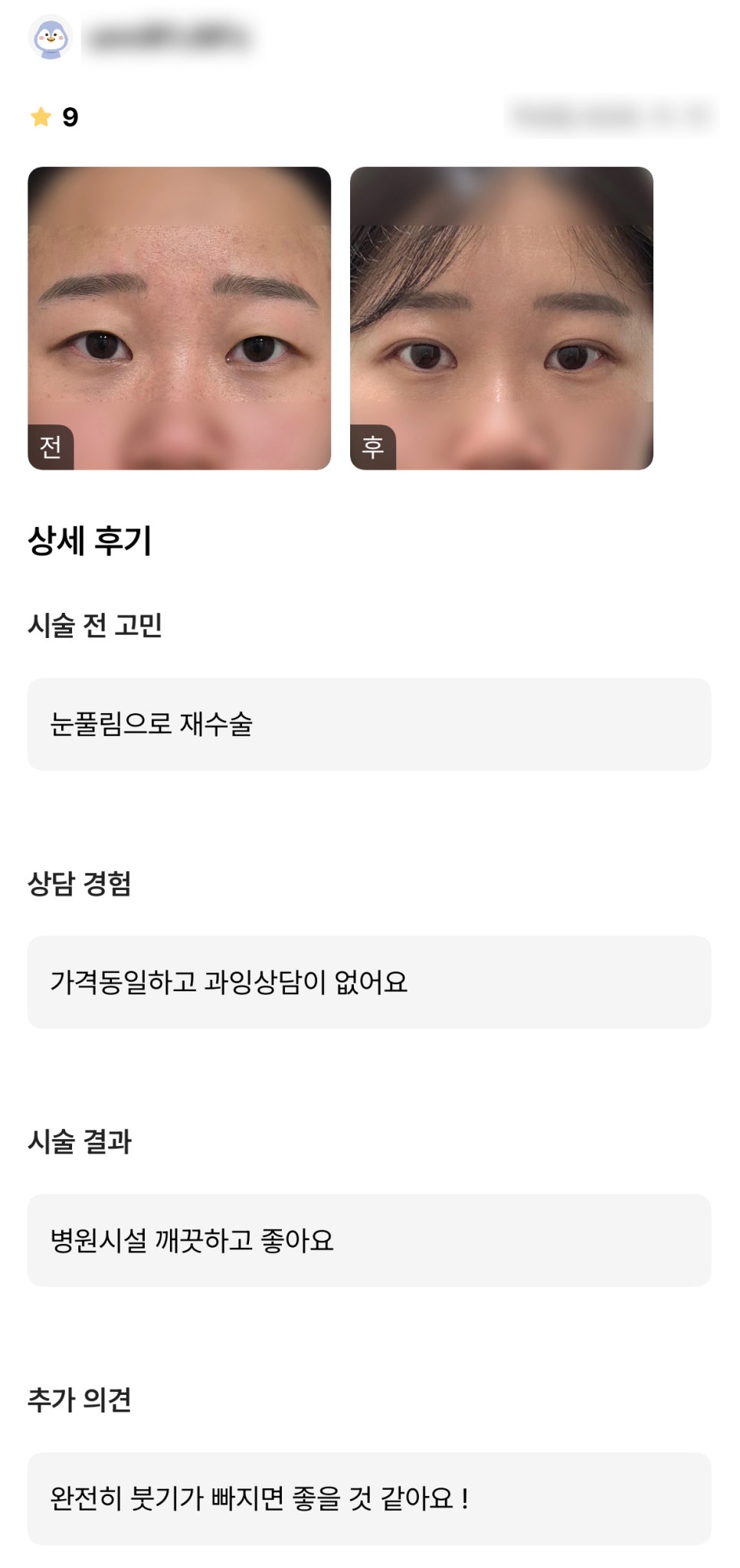 DM Revision Eyelid Surgery/Back-Wing Eye Corner Surgery Review, “The price is the same and there was no excessive consultation!” image 1
