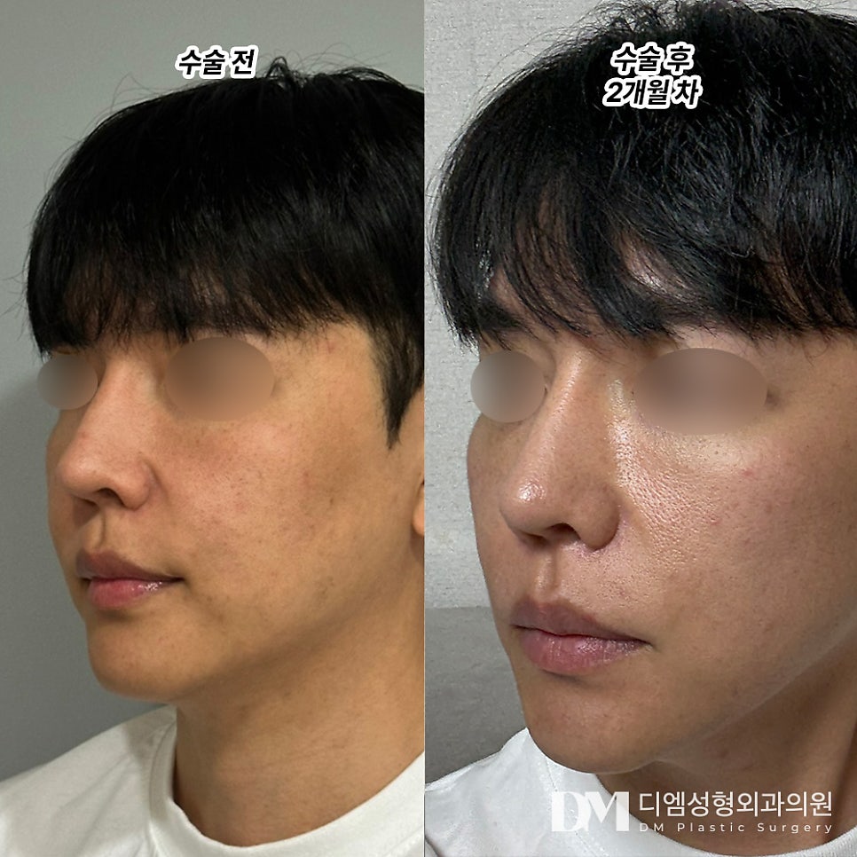 반거상 후기."자연스럽고 과한 부분이 없어서 좋아요!" 관련 이미지 2