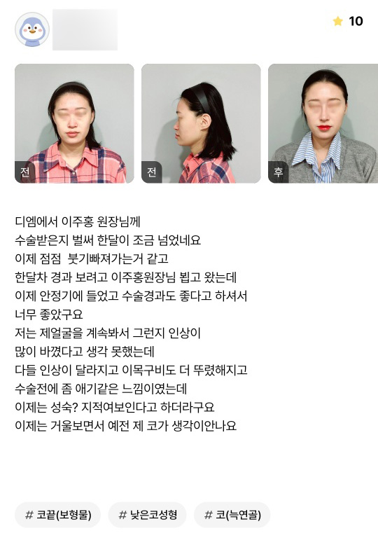 코성형 후기."다들 성숙하고 지적여 보인대요 !" 관련 이미지 1