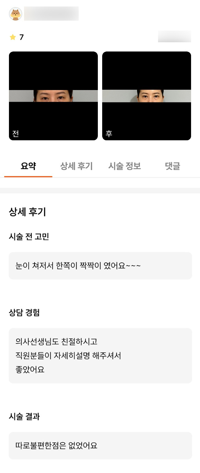 눈성형 후기."불편한 점 없어서 좋아요!" 관련 이미지 1