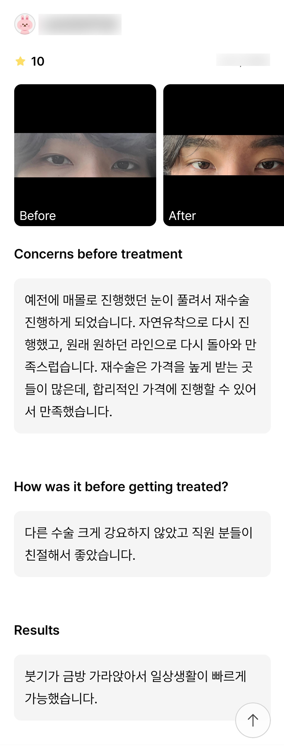 Review of Revision Eyelid Surgery. “I was glad I could proceed at a reasonable price!” image 1