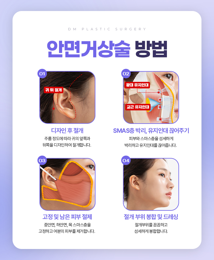 안면거상, 힘없이 늘어진 피부가 고민이라면 관련 이미지 7