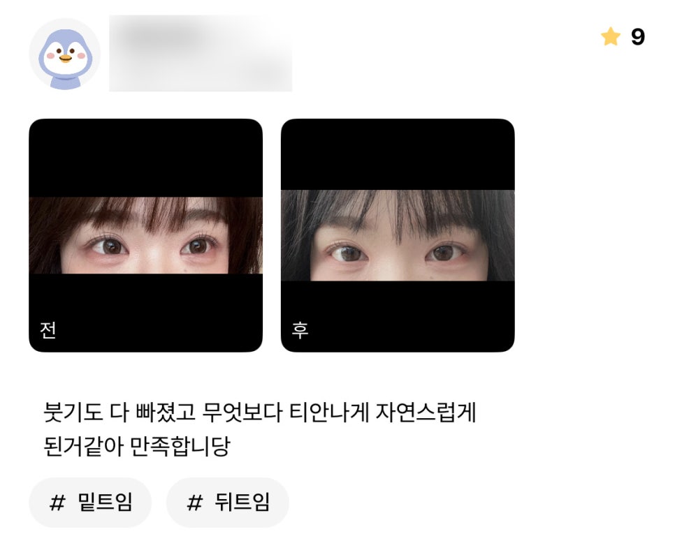 빵트임 후기."티 안나게 자연스럽게 된 거 같아 만족합니당" 관련 이미지 1
