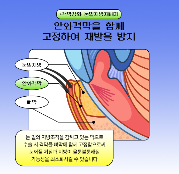 눈밑지방재배치, 노안 이미지와 피곤한 인상이 고민이라면 관련 이미지 5