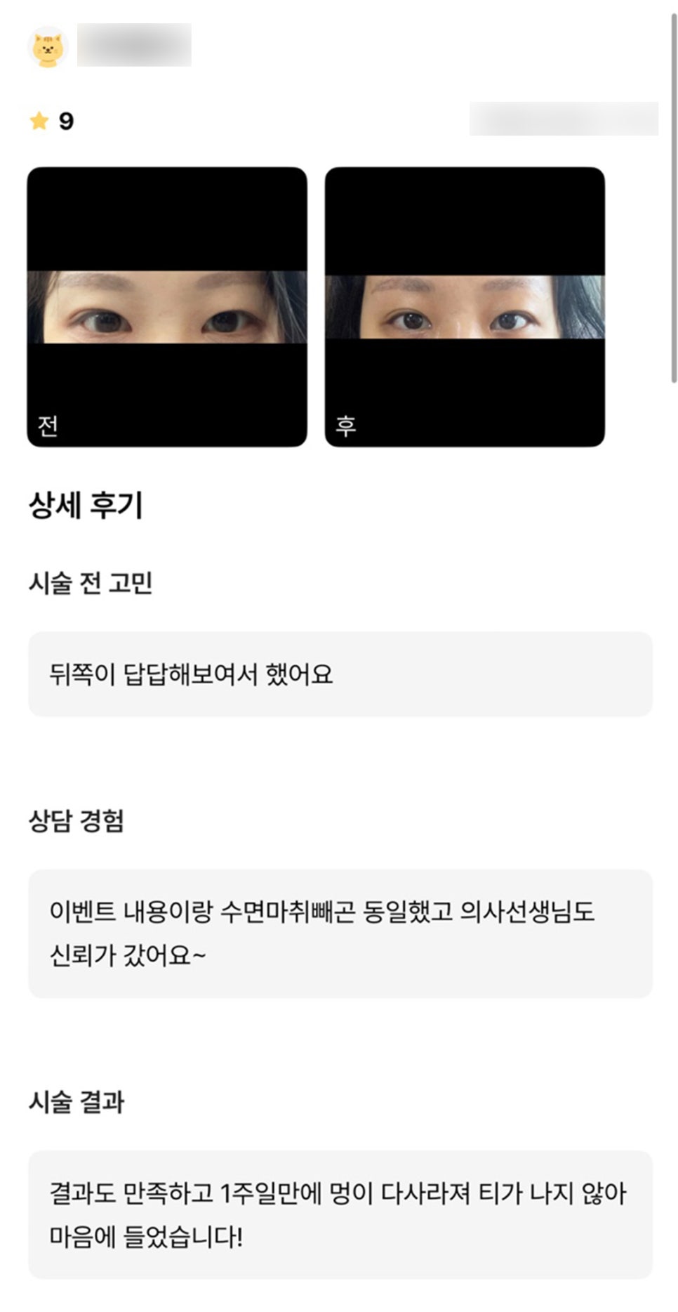 빵트임 후기."결과도 만족하고 일주일만에 멍이 다 사라져티가 나지 않아 마음에 들었습니다 ! " 관련 이미지 1