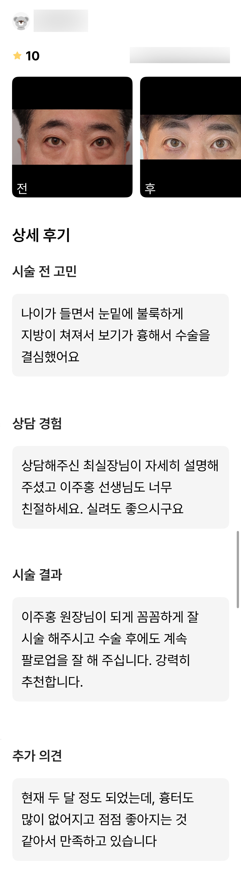 하안검 후기."강력히 추천하며 만족하고 있습니다 !" 관련 이미지 1