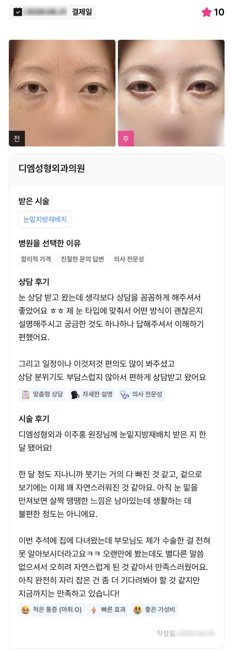 디엠 눈밑지방재배치/눈밑지방이식 수술후기, “자연스럽게 된 것 같아서 만족스러워요!” 관련 이미지 1