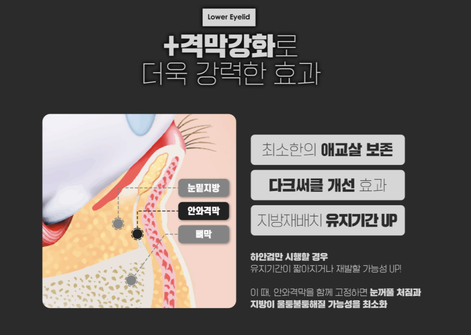 하안검, 눈 밑 노화가 고민이라면? 관련 이미지 6