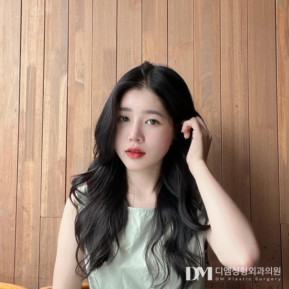 흉터 걱정 덜어주는 반거상술,안면거상과 차이는? 관련 이미지 1