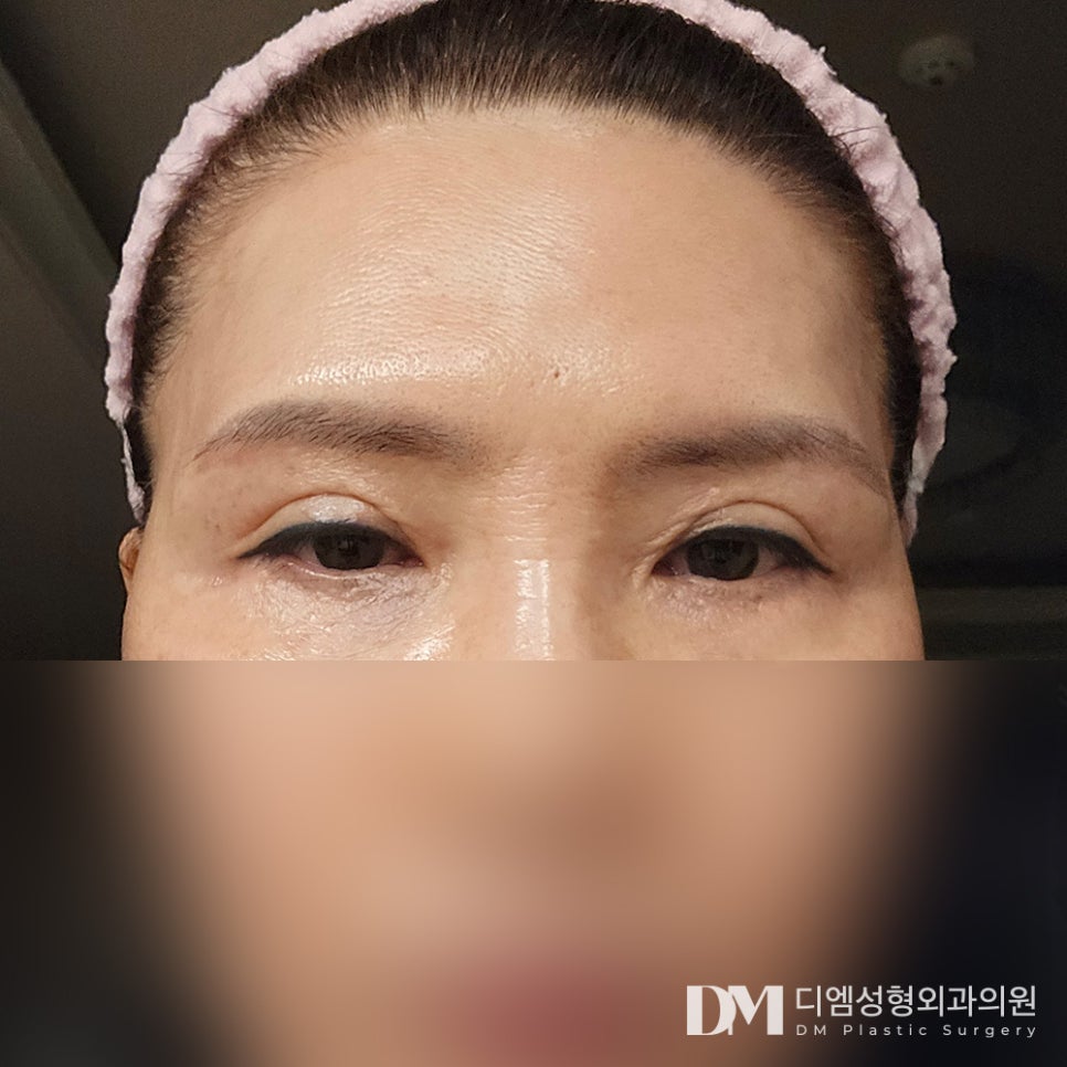 엔도타인 없는 이마거상, 20대부터 60대까지 관련 이미지 8