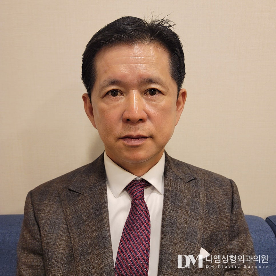 상안검 , 시야확보부터 동안 효과까지 ! 관련 이미지 1