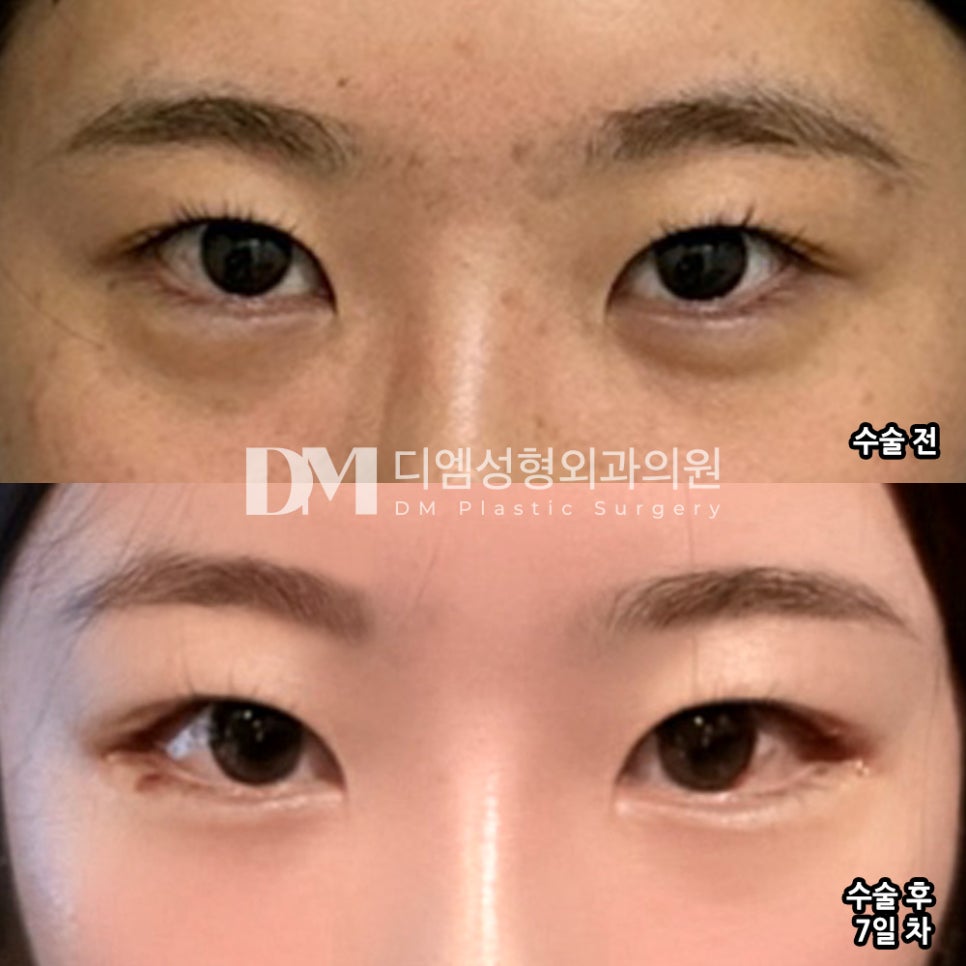 빵트임 후기."왜 고민했나 싶을 정도로 엄청 만족해요ㅠㅠ!" 관련 이미지 2