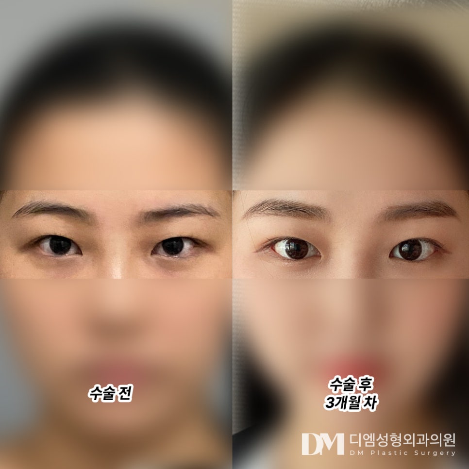 빵트임 후기."흉도 없고 붙지도 않아서 만족해요 !" 관련 이미지 2