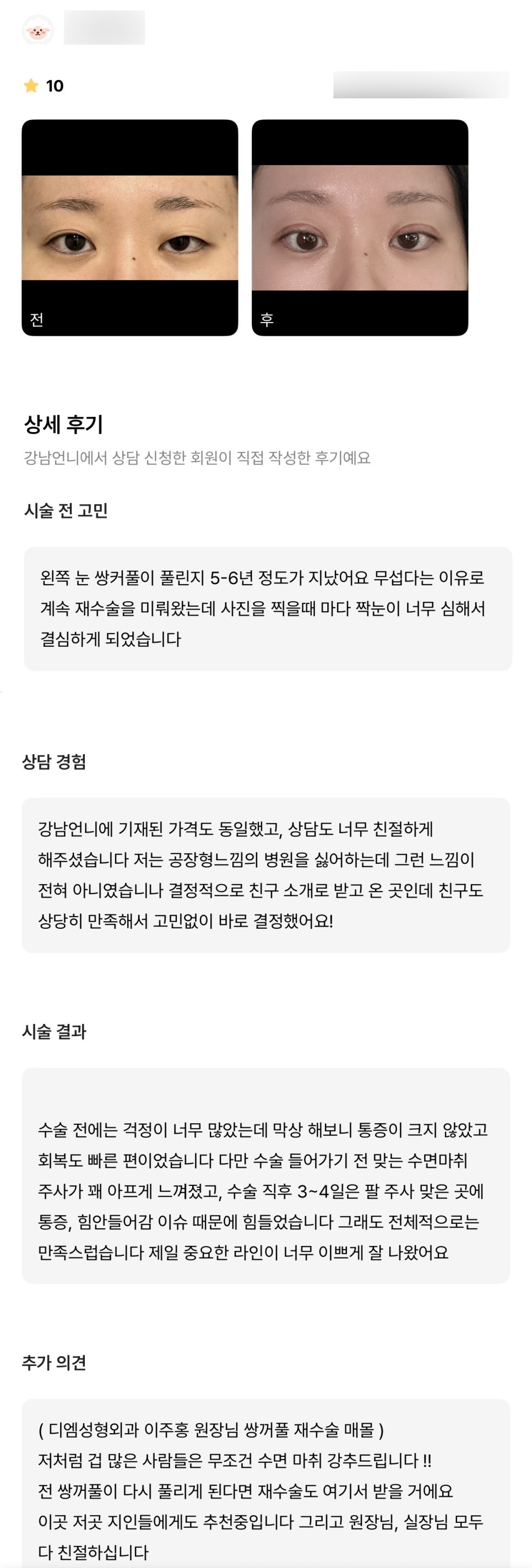 Eyelid Reoperation Review. “If my double eyelid crease loosens again, I’ll have the reoperation done here too!” image 1