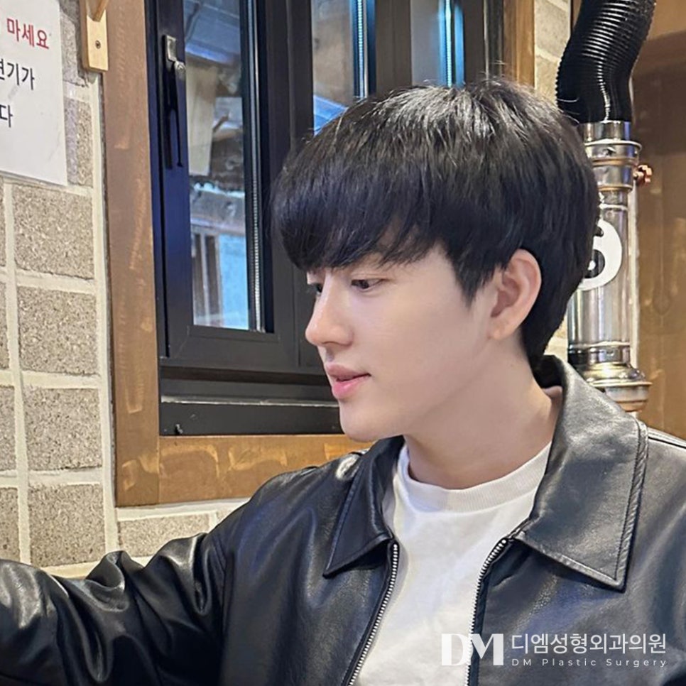 코끝성형, 뭉툭한 코가 스트레스라면?! 관련 이미지 12