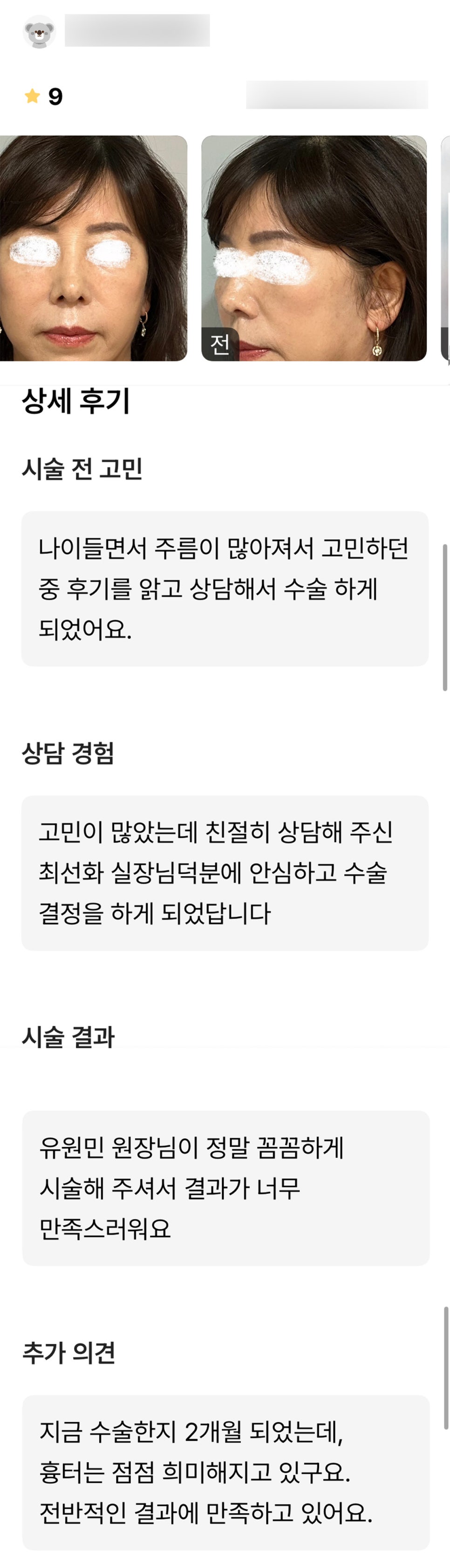 안면거상 후기."꼼꼼하게 해주셨고 너무 만족스러워요!" 관련 이미지 1