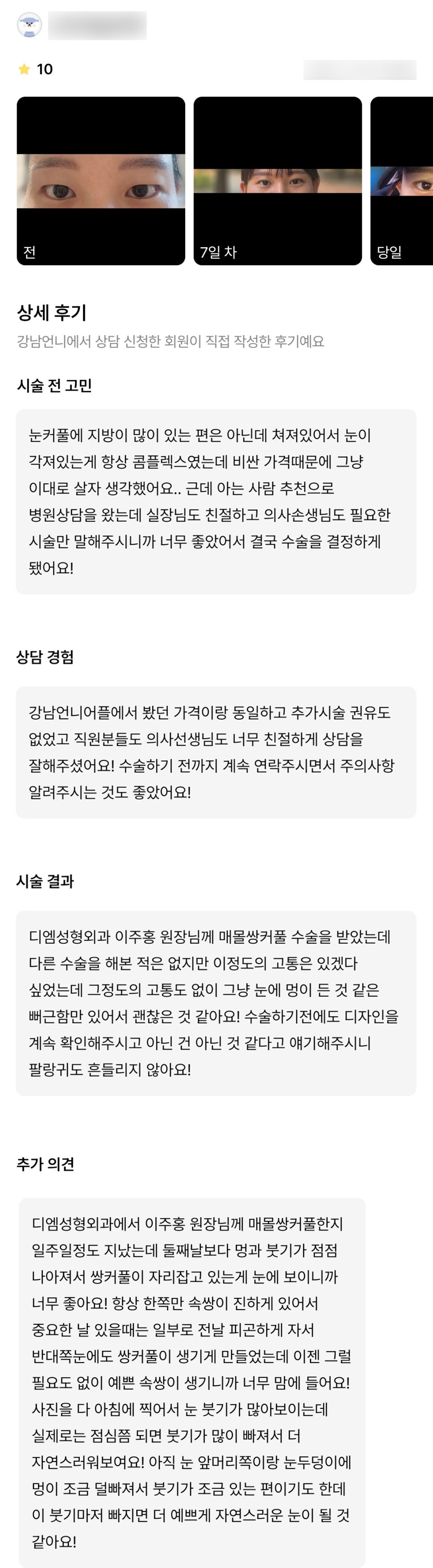 눈성형 후기."예쁜 속쌍이 생기니까 너무 맘에 들어요!" 관련 이미지 1