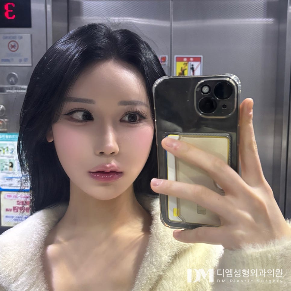 눈재수술, 숙련된 기술로 흉터를 최소화 해 내 것 처럼 관련 이미지 14