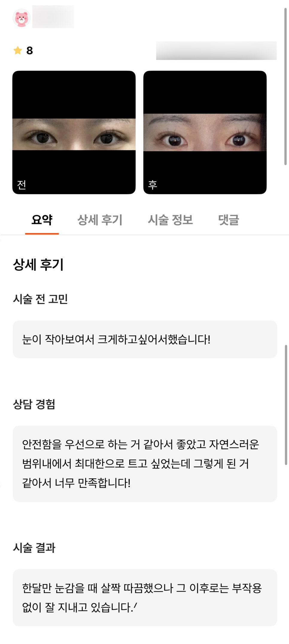 빵트임 후기."자연스럽게 최대한 트고 싶었어서 너무 만족합니다!" 관련 이미지 1