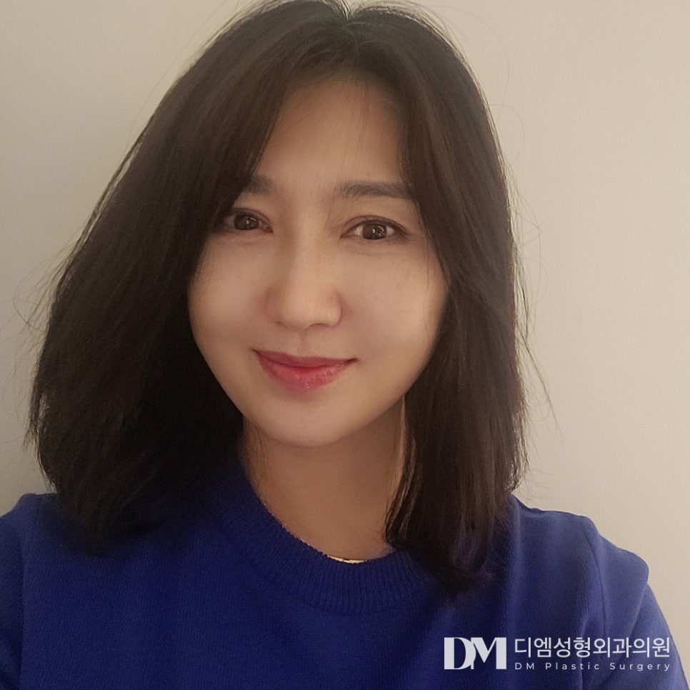 겉 피부만 당기는 건 NO!, 유지기간 길어지는 안면거상 수술방법은? 관련 이미지 1
