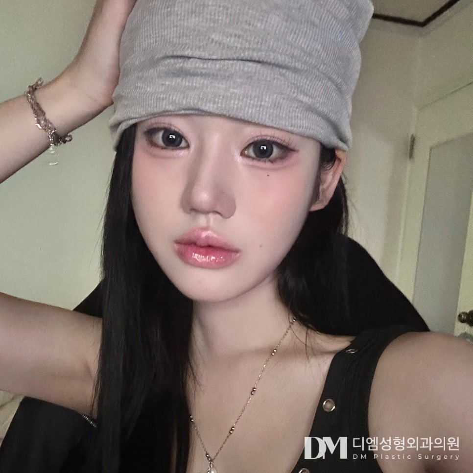 화살코 성형, 컴플렉스 극복은 물론 자신감 충전까지 ! 관련 이미지 1