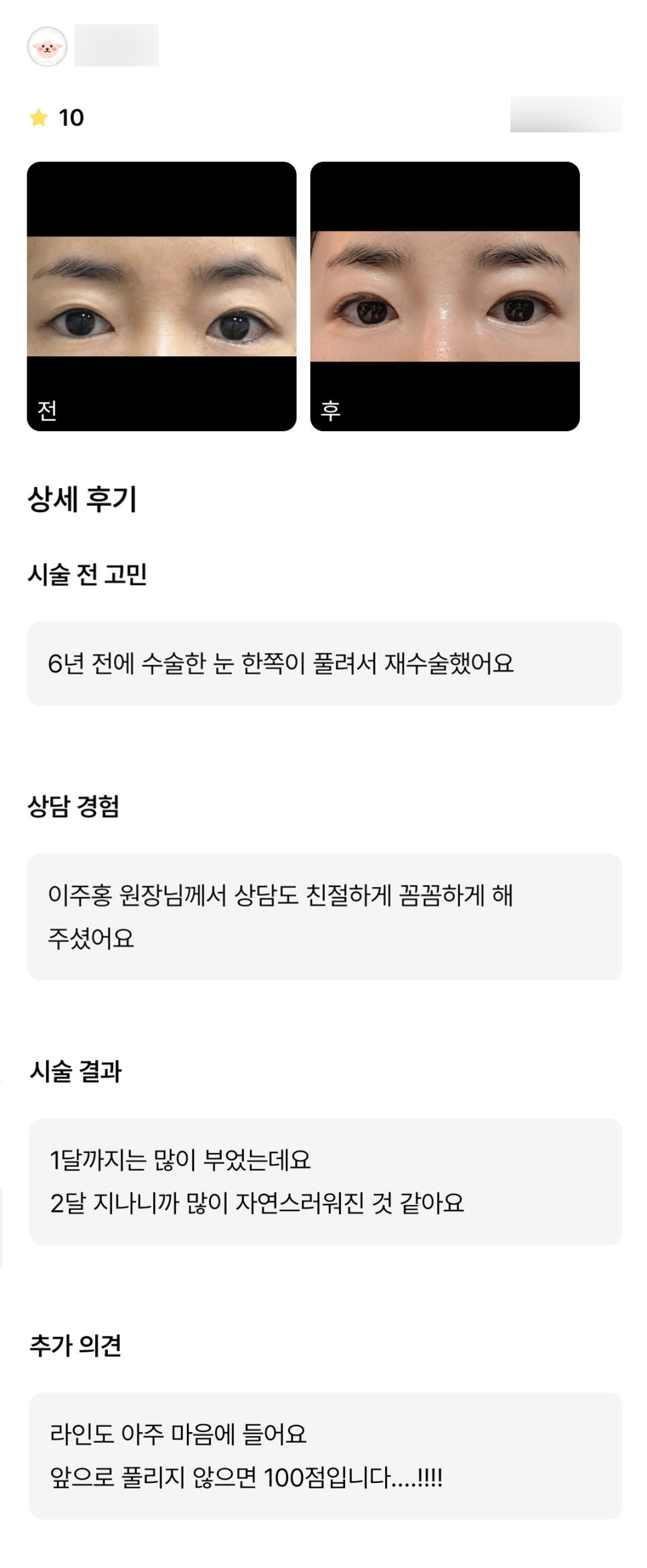 눈재수술 후기."많이 자연스러워진 것 같아요 라인도 아주 마음에 들어요!" 관련 이미지 1