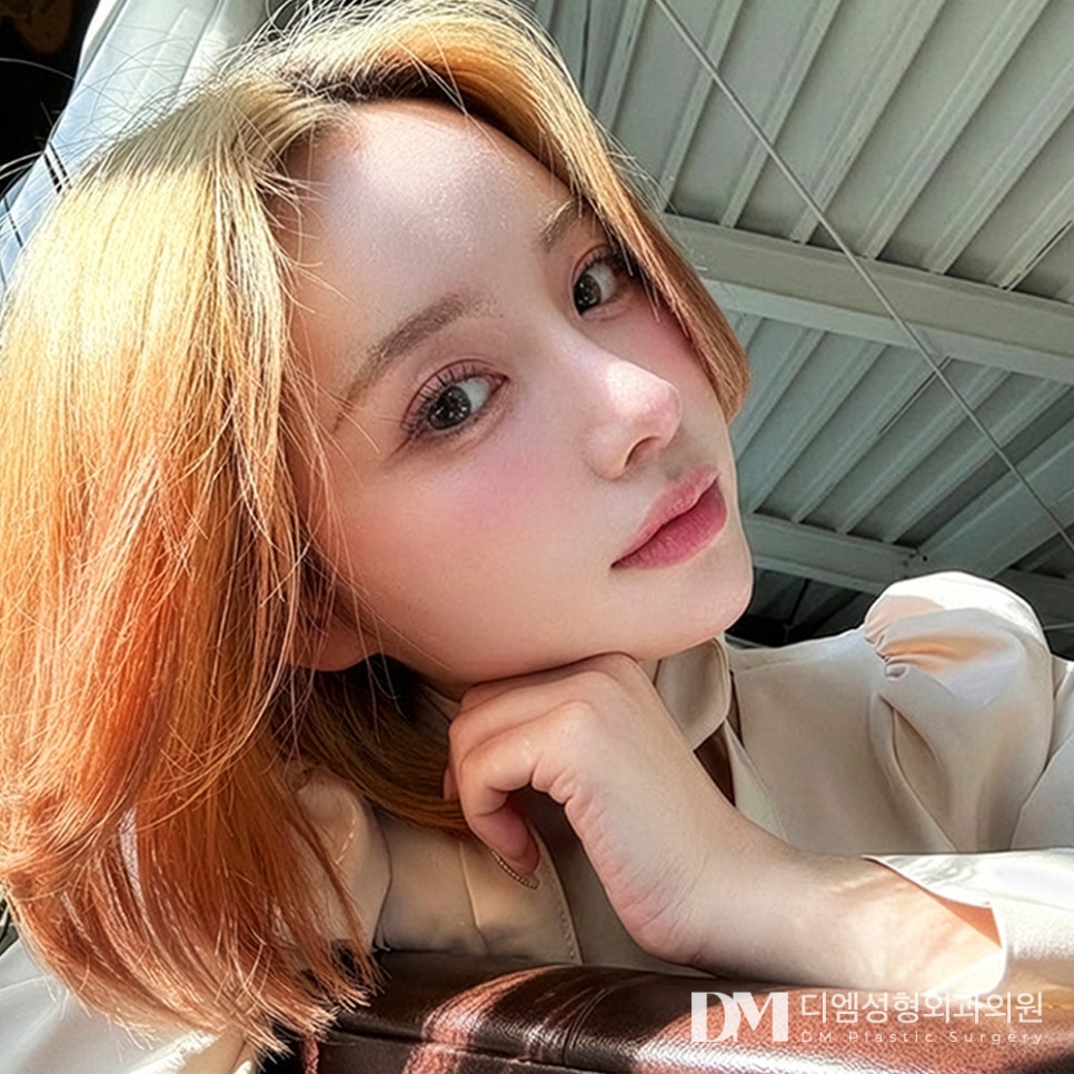눈재수술은 언제 가능할까? 적절한 시기 알아보기! 관련 이미지 1