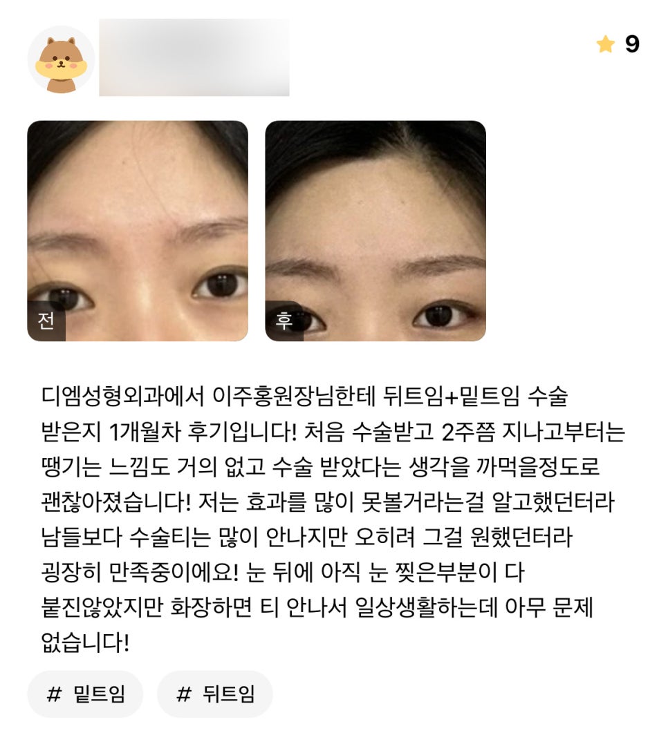 빵트임 후기."티 많이 안나는걸 원했어서 굉장히 만족중입니다!" 관련 이미지 1