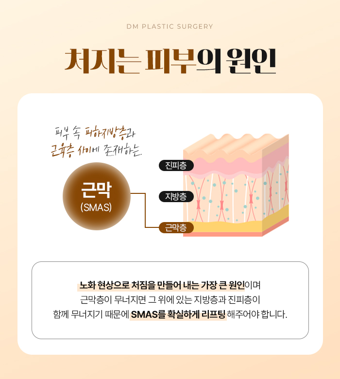 안면거상, 탄력을 잃은 피부가 고민이라면 관련 이미지 7
