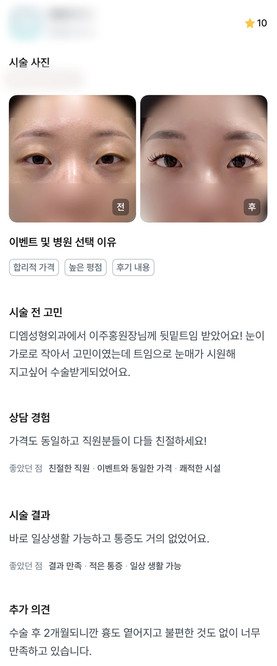 디엠 뒤밑트임/트임성형 후기, “불편한 것도 없이 너무 만족하고 있습니다!” 관련 이미지 1