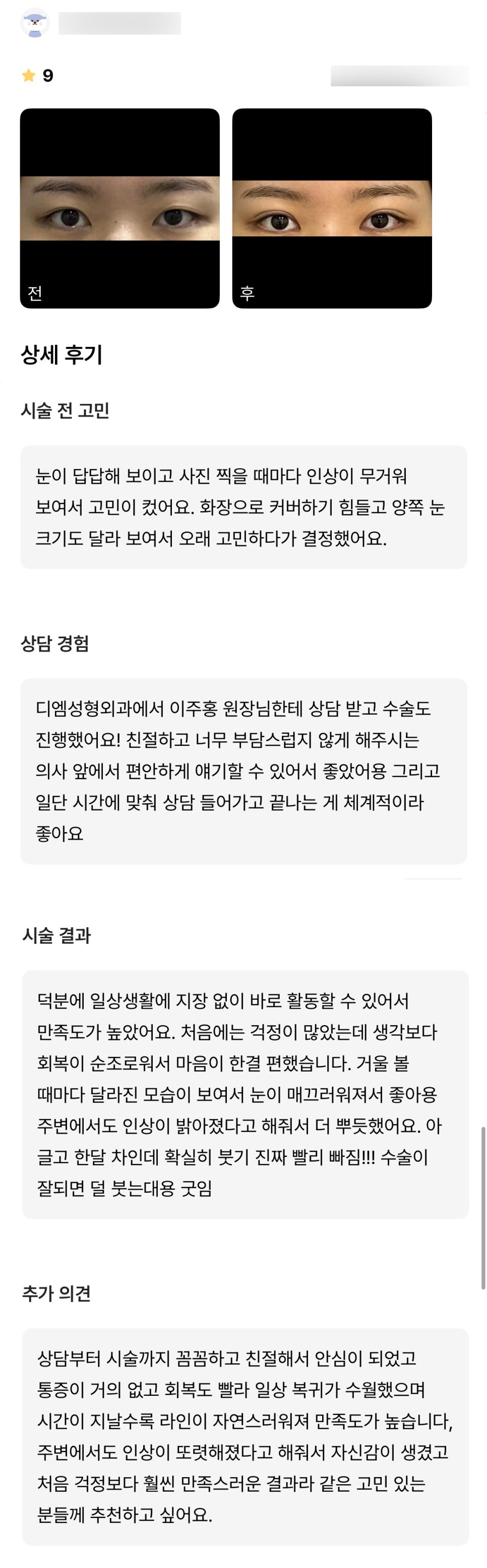 눈재수술 후기."주변에서도 인상이 또렷해졌다고 해줘서 자신감이 생겼어요!" 관련 이미지 1