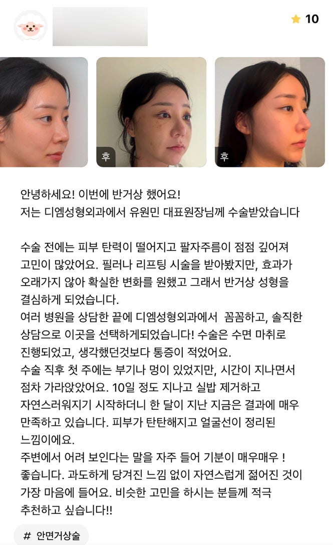 반거상 후기."피부가 탄탄해지고 얼굴선이 정리된 느낌이에요!" 관련 이미지 1