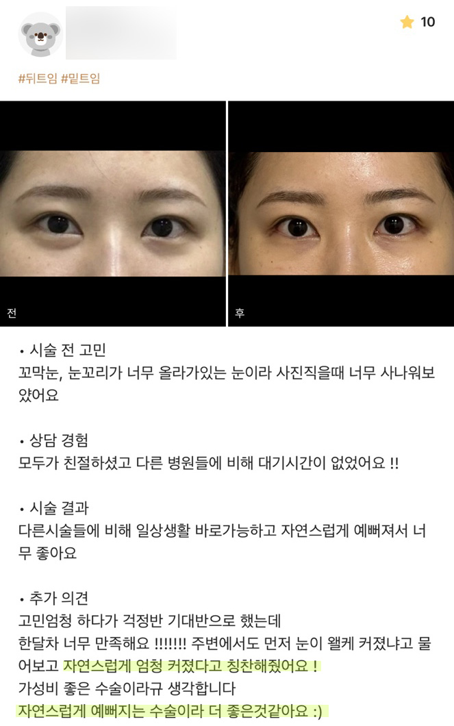 Bbang Teum Review. "I like it even more because it’s a surgery that makes you look naturally prettier!" image 1