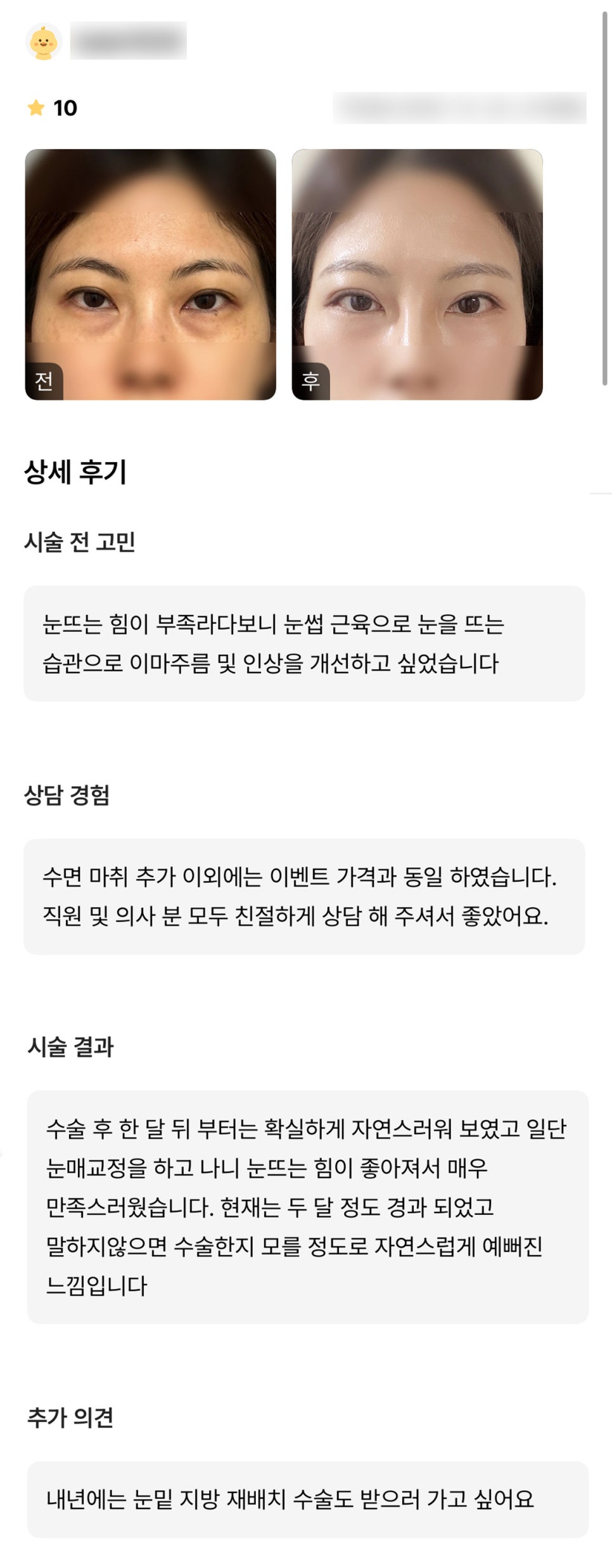 눈성형 후기."말하지 않으면 수술한 지 모를정도로 자연스럽게 예뻐진 느낌입니다!" 관련 이미지 1
