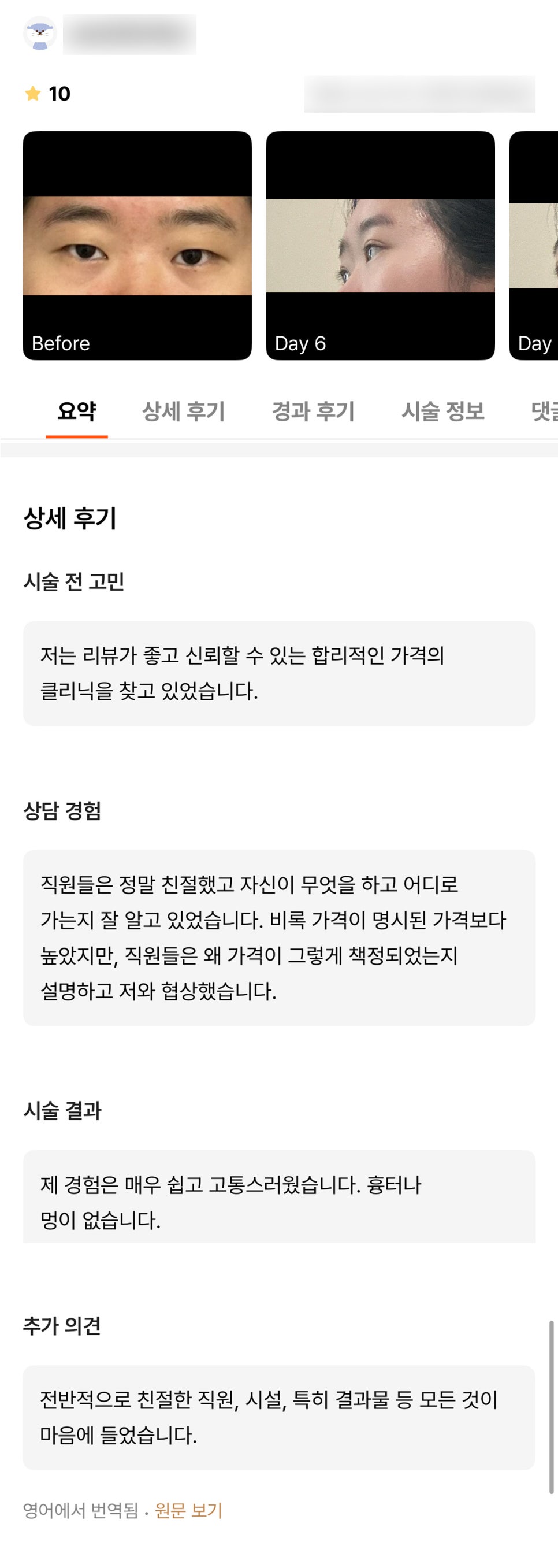 눈성형 후기."전반적으로 친절한 직원,시설 ,특히 결과물 등 모든것이 마음에 들었습니다." 관련 이미지 1